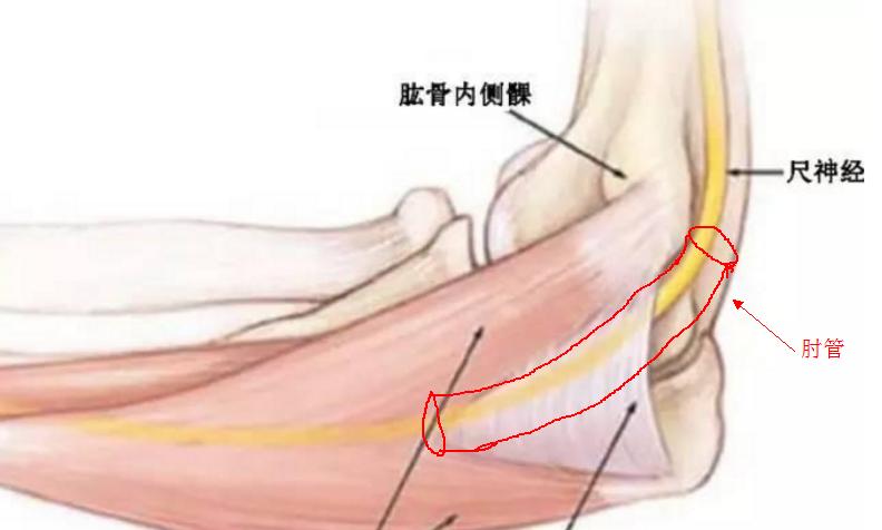 高尔夫球肘是筋膜炎吗